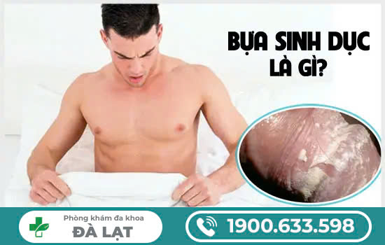 Hình ảnh minh họa